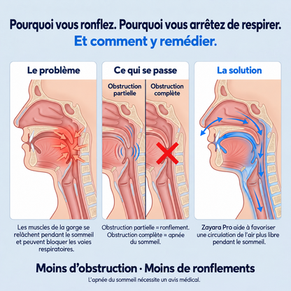 Zayara™ Pro — Élimine les ronflements et l’apnée du sommeil